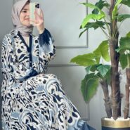 Siyah Desenli Önü Patlı Elbise (1)